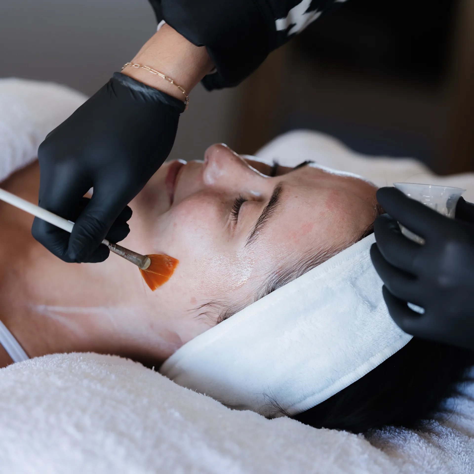 Elio Dermal Services 1